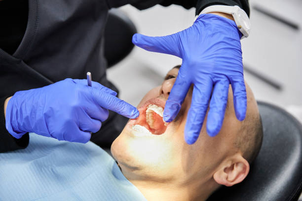 Best Emergency Wisdom Teeth Removal in Glouster, OH